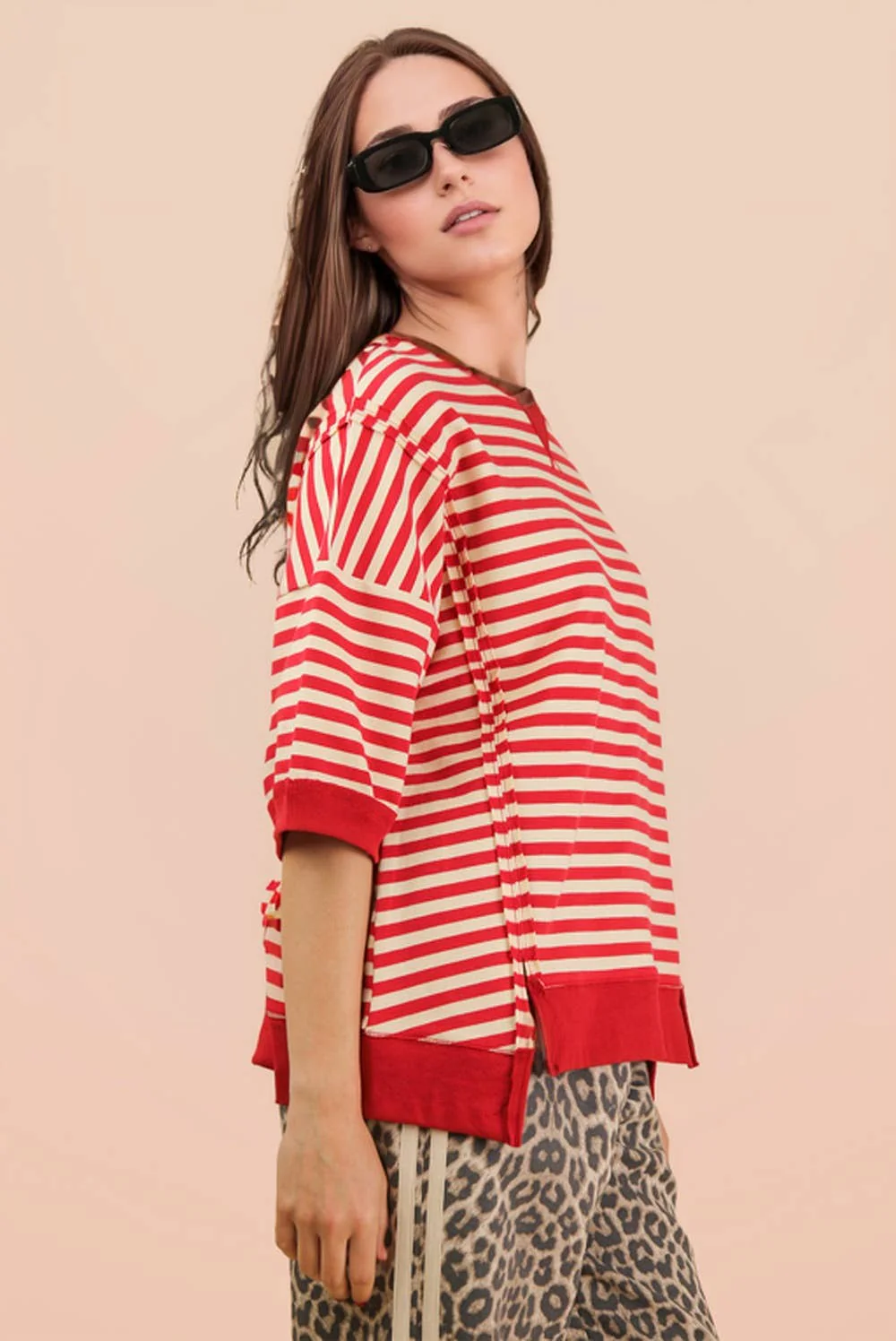 Tinley Oversized Stripe Top - Image 5